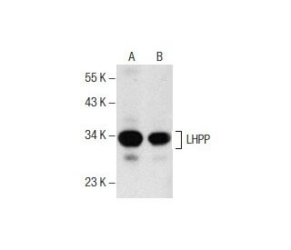 LHPP Antibody (B-2) - Western Blotting - Image 157670