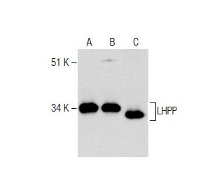 LHPP Antibody (B-2) - Western Blotting - Image 282612 