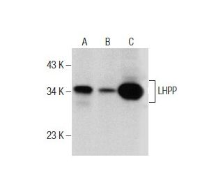 LHPP Antibody (H-2) - Western Blotting - Image 156216 