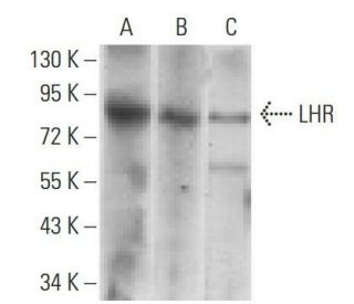 LHR Antibody (8G9A2) - Western Blotting - Image 358343SAM Transcription Activation: SAM system utilizing dCas9-VP64, MS2-P65-HSF1, and sgRNA for precise gene transcription activation.