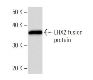 LHX2 Antibody (LHX2A12G1) - Western Blotting - Image 16863