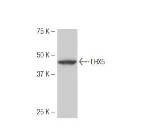 LHX5 Antibody (KP-02) - Western Blotting - Image 54013 