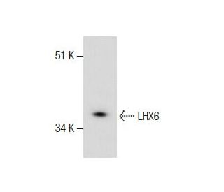 LHX6 Antibody (A-9) | SCBT - Santa Cruz Biotechnology