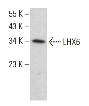 小物 aks LHX6 Antibody (A-9) | SCBT - Santa Cruz Biotechnology