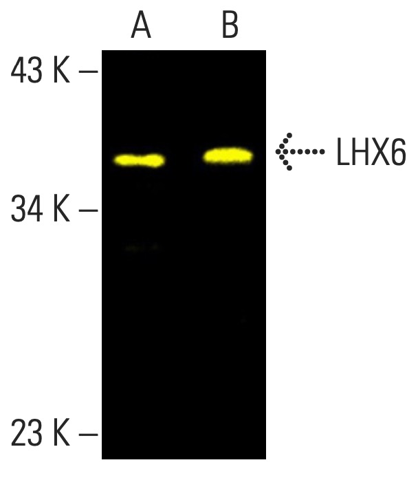 小物 aks LHX6 Antibody (A-9) | SCBT - Santa Cruz Biotechnology