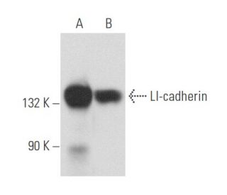 western blotting image from recommended LI-cadherin (H-1) monoclonal antibody replacement. Image 357472
