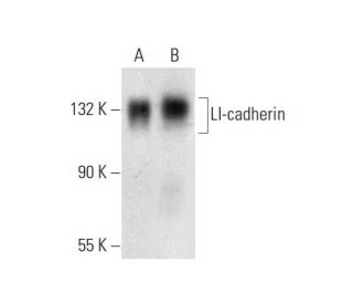 LI-cadherin Antibody (H-1) | SCBT - Santa Cruz Biotechnology