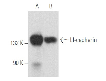 LI-cadherin Antibody (H-1) | SCBT - Santa Cruz Biotechnology