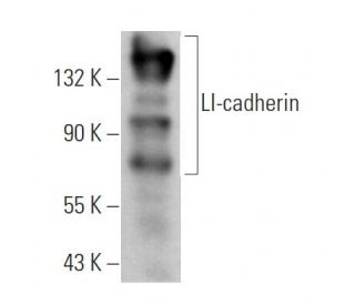 LI-cadherin Antibody (H-1) | SCBT - Santa Cruz Biotechnology