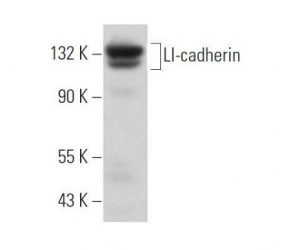 LI-cadherin Antibody (H-1) | SCBT - Santa Cruz Biotechnology