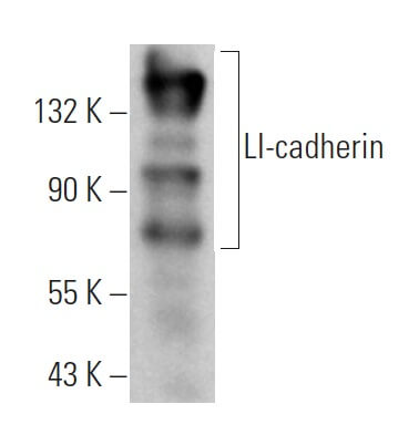 LI-cadherin Antibody (H-1) | SCBT - Santa Cruz Biotechnology