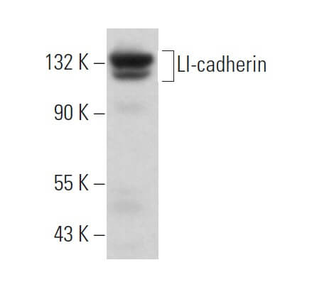 LI-cadherin Antibody (H-1) | SCBT - Santa Cruz Biotechnology