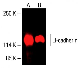 LI-cadherin Antibody (H-1) | SCBT - Santa Cruz Biotechnology