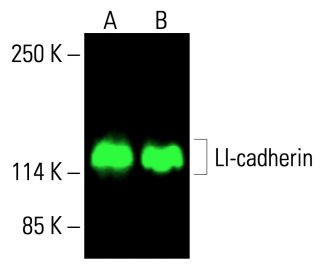 LI-cadherin Antibody (H-1) - Western Blotting - Image 416384 