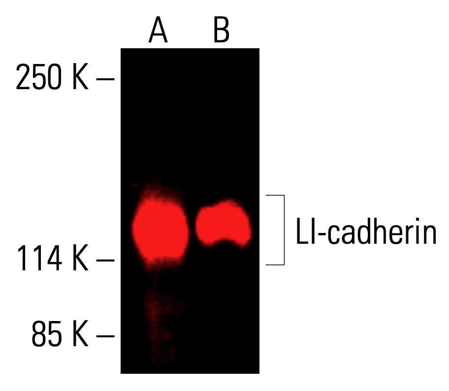 LI-cadherin Antibody (H-1) | SCBT - Santa Cruz Biotechnology
