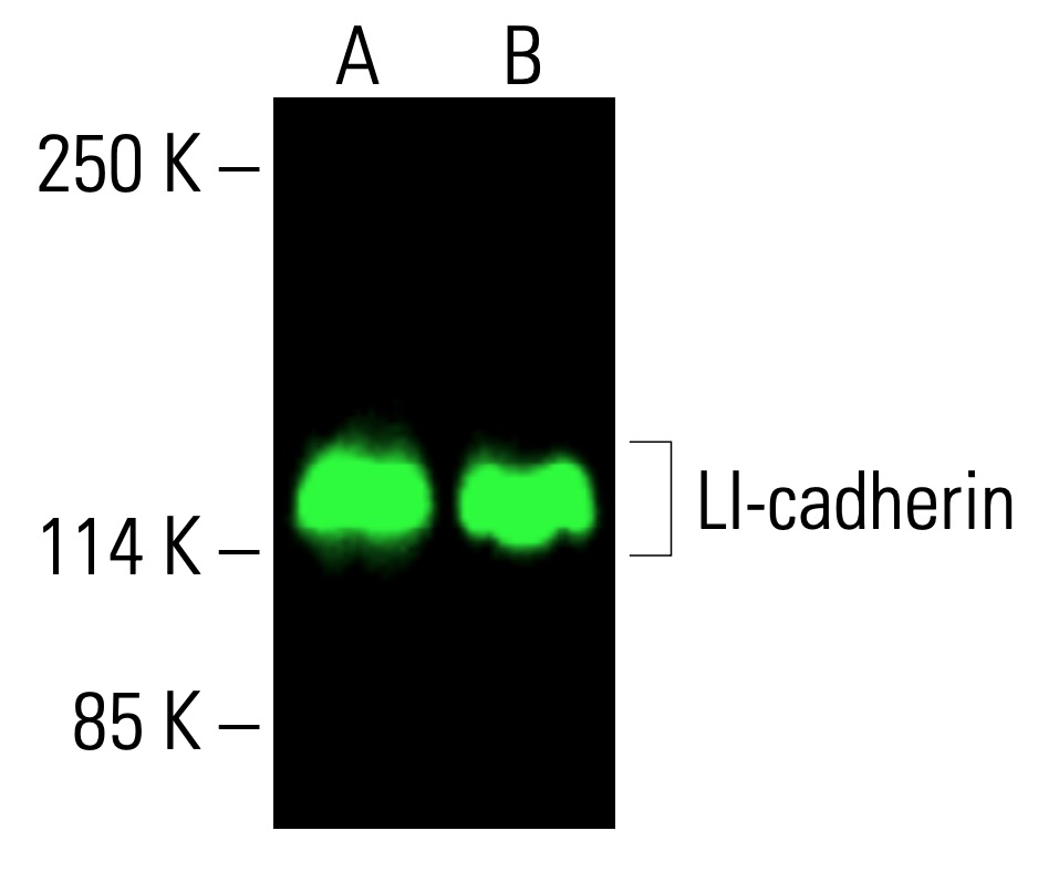 LI-cadherin Antibody (H-1) | SCBT - Santa Cruz Biotechnology