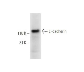 LI-cadherin Antibody (B-1) - Western Blotting - Image 291904The Double Nickase Plasmid features a U6 promoter for sgRNA expression, a 20 nt targeting sequence, and a gRNA scaffold to guide Cas9n. It includes a CBh promoter for Cas9n (D10A) and puromycin resistance, GFP for transfection verification, and nuclear localization signals (NLS). The 2A peptide allows co-expression of Cas9n and Puro from a single promoter, enabling precise genome editing with reduced off-target effects.