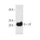 LIF Antibody (E-10) - Western Blotting - Image 382024