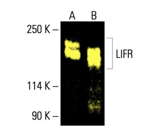 western blotting image from recommended LIFR (A-10) monoclonal antibody replacement. Image 404921