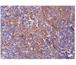 LIME Antibody (D-6) - Immunohistochemistry - Image 159638 