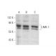 LIMK-1 Antibody (E-7) - Western Blotting - Image 11800 