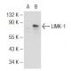 LIMK-1 Antibody (E-7) - Western Blotting - Image 127029