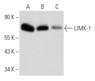 LIMK-1 Antibody (E-7) - Western Blotting - Image 356923 
