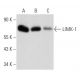 LIMK-1 Antibody (E-7) - Western Blotting - Image 356923 