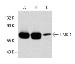 western blotting image from recommended LIMK-1 (H-12) monoclonal antibody replacement. Image 356924
