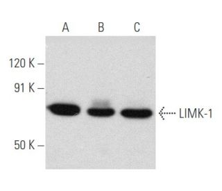 LIMK-1 Antibody (C-10) - Western Blotting - Image 356640Each CRISPR/Cas9 Knockout (KO) Plasmid product consists of a pool of 3 plasmids designed to ensure identification and cleavage of a specific gene for maximum knockout efficiency. Each plasmid encodes a unique 20 nt sequence derived from the GeCKO (v2) library.