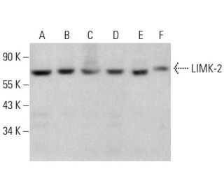 western blotting image from recommended LIMK-2 (A-12) monoclonal antibody replacement. Image 381301