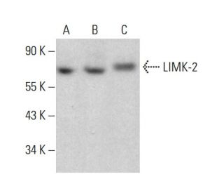 LIMK-2 Antibody (A-12) - Western Blotting - Image 381300