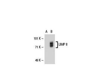 LIMP II Antibody (D-4) - Western Blotting - Image 20069