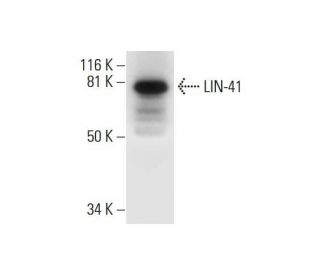 LIN-41 Antibody (B-12) - Western Blotting - Image 294663