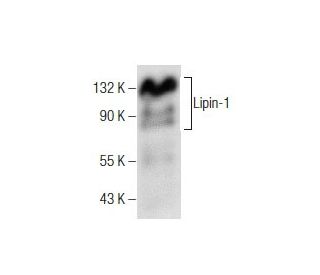 western blotting image from recommended Lipin-1 (B-12) monoclonal antibody replacement. Image 160872