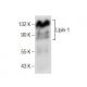 This polyclonal antibody has been discontinued. See our recommended <a href="lipin-1-antibody-b-12">Lipin-1 (B-12)</a> monoclonal antibody (sample data shown). western blotting image from recommended Lipin-1 (B-12) monoclonal antibody replacement. Image 160872