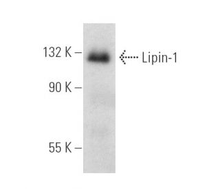 Lipin-1 Antibody (B-12) - Western Blotting - Image 389396Each CRISPR/Cas9 Knockout (KO) Plasmid product consists of a pool of 3 plasmids designed to ensure identification and cleavage of a specific gene for maximum knockout efficiency. Each plasmid encodes a unique 20 nt sequence derived from the GeCKO (v2) library. 