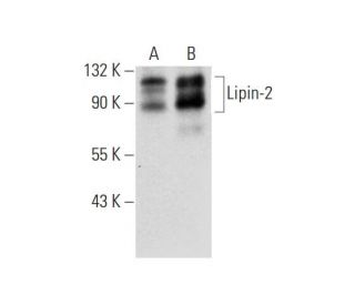 Lipin-2 Antibody (G-7) - Western Blotting - Image 318544 