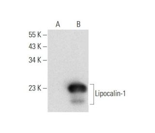 Lipocalin-1 Antibody (B-9) - Western Blotting - Image 312002
