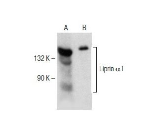 Liprin Î+/-1 Antibody (A-2): sc-374477