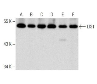 western blotting image from recommended LIS1 (H-7) monoclonal antibody replacement. Image 356990
