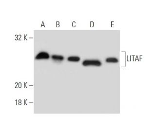 LITAF Antibody (30) - Western Blotting - Image 139483 