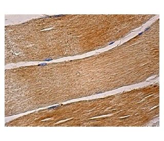 LKB1 Antibody (G-12) - Immunohistochemistry - Image 159135 