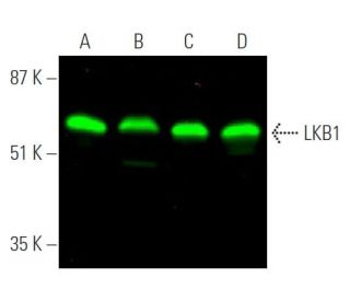 LKB1 Antibody (Ley 37D/G6) - Western Blotting - Image 375253