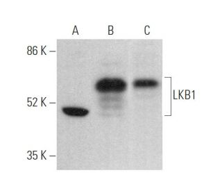 LKB1 Antibody (Ley 37D/G6) - Western Blotting - Image 373974