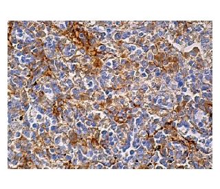 immunohistochemistry image from recommended LL-37 (D-5) monoclonal antibody replacement. Image 159513