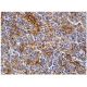 immunohistochemistry image from recommended LL-37 (D-5) monoclonal antibody replacement. Image 159513
