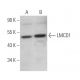 LMCD1 Antibody (F-11) - Western Blotting - Image 371734