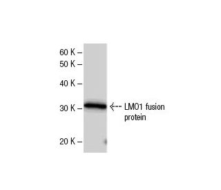 LMO1 Antibody (790C2a) - Western Blotting - Image 47851