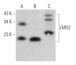 western blotting image from recommended LMO2 (1A9-1) monoclonal antibody replacement. Image 363523